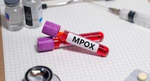 According to WHO, Mpox remains a health emergency